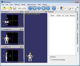 3DimViewer main screen